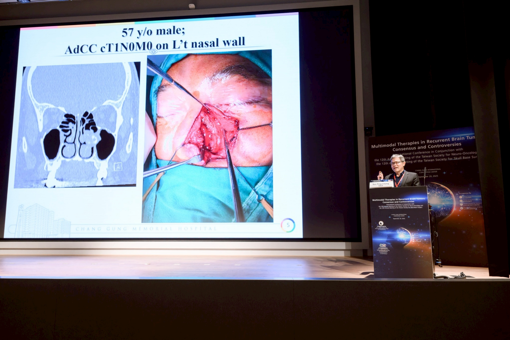 2025.09.20 台灣神經腫瘤學學會第十二屆聯合年會暨國際學術研討會