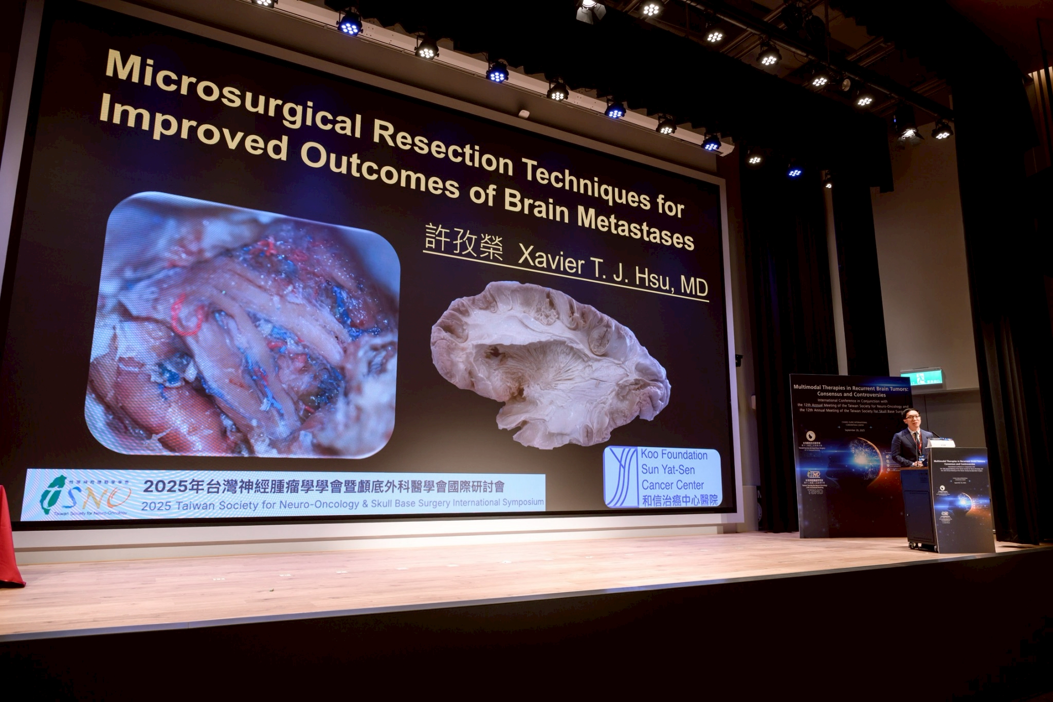 2025.09.20 台灣神經腫瘤學學會第十二屆聯合年會暨國際學術研討會